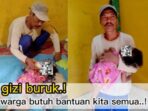 Alami gizi buruk gadis kecil usia 3 tahun asal kaur butuh bantuan kita semua