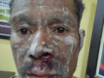 Berawal Dari Masalah Tanah Sawah Korban Dianiaya Oleh Pelaku Hingga Babak Belur